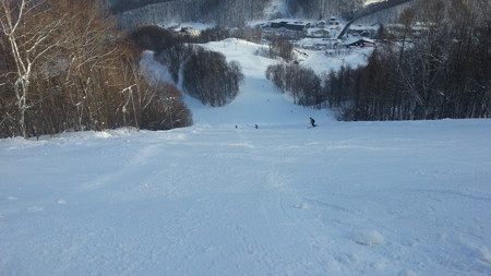 20160227_083541